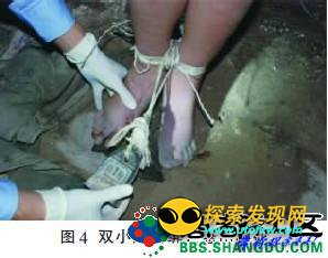 重庆红衣男孩事件:蛤蟆续命术