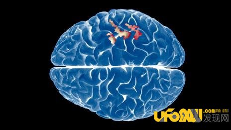 人类大脑开发到一定程度可以重组?