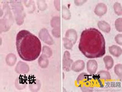 绿杨烟外晓寒轻:卟啉是什么,有什么用?