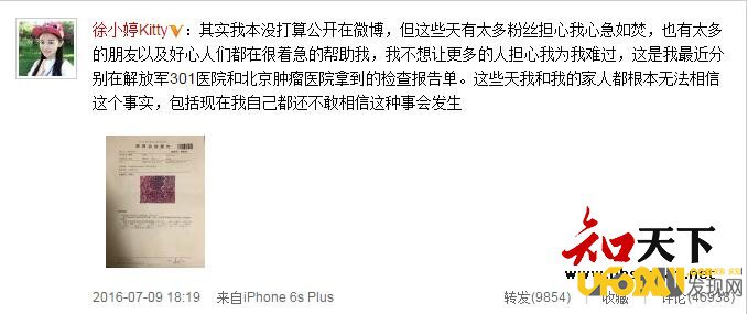 Ů��Ա���ò��ŵ�ԭ��������ܰͰ�ȥ������