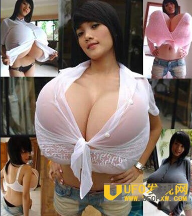 女童患巨乳症照片