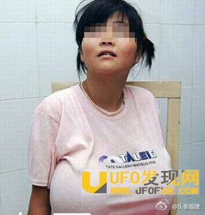 女童患巨乳症照片