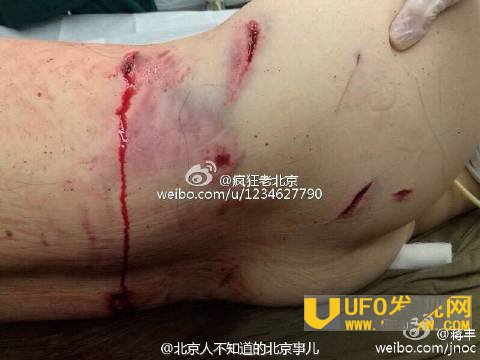老虎咬人事件怎么赔偿