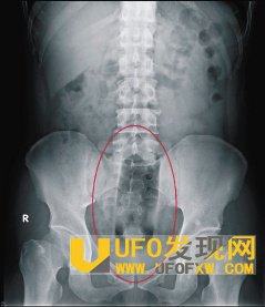 男性肛门自慰方式
