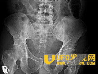 男性肛门自慰方式