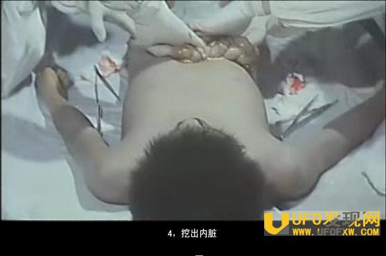 在女性身上试验梅毒资料图