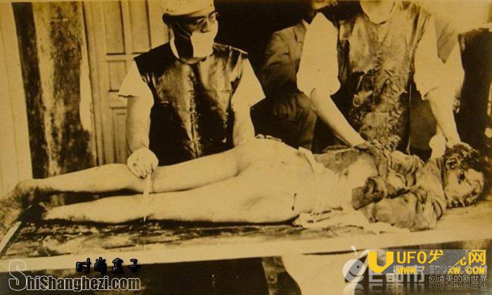 在女性身上试验梅毒资料图