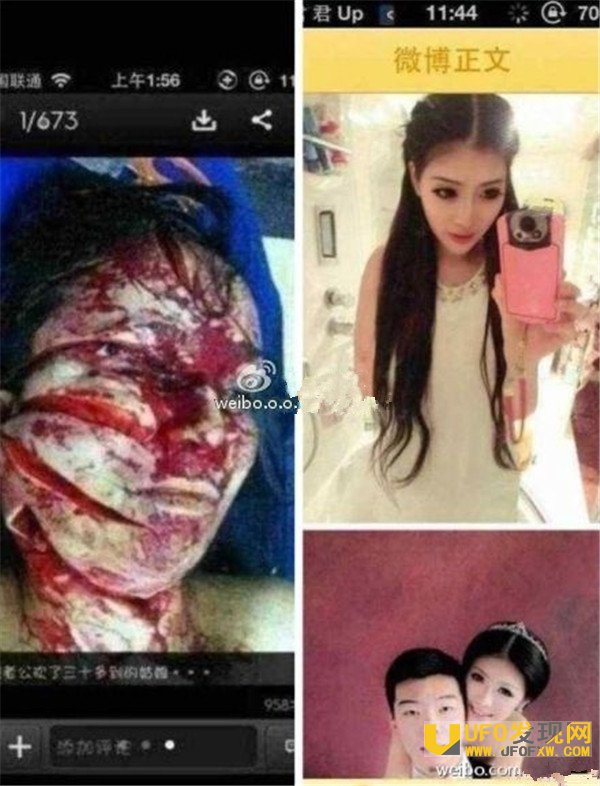 祁可欣被砍的全身照片